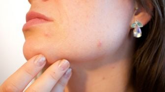 Tutorial Make Up Untuk Wajah Berjerawat, Cocok untuk Pemula!