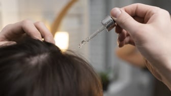 5 Minyak Kemiri untuk Mengatasi Rambut Rontok, Bantu Menguatkan Akar dan Bikin Tebal